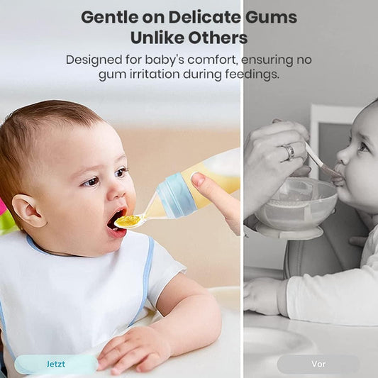 SqueezeEase™ Baby Feeder
